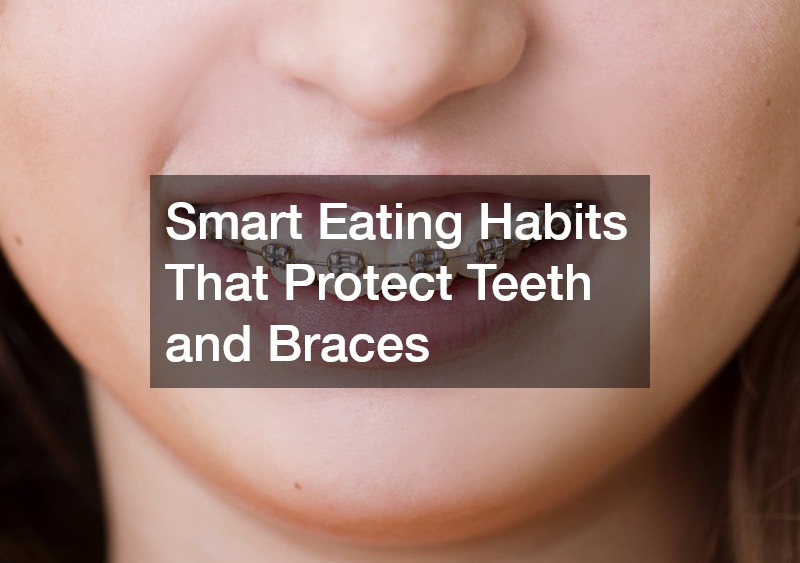Smart Eating Habits That Protect Teeth and Braces